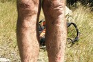 Battered legs